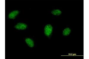 Immunofluorescence of purified MaxPab antibody to BIRC4BP on HeLa cell.