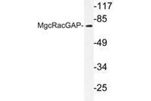 Western blot analysis of MgcRacGAP antibody in extracts from COS7 cells. (RACGAP1 antibody)