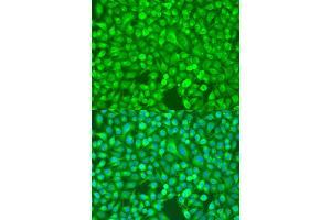 Immunohistochemistry of paraffin-embedded rat heart using NFKB2 Antibody (ABIN1873900) at dilution of 1:100 (40x lens). (NFKB2 antibody)