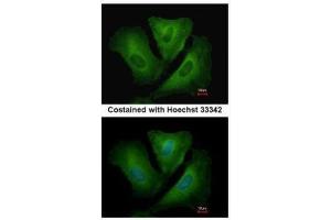 ICC/IF Image Immunofluorescence analysis of methanol-fixed A549, using HLA-DRB3, antibody at 1:500 dilution. (HLA-DRB3 antibody)
