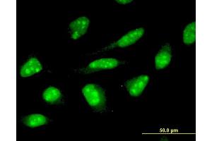 Immunofluorescence of monoclonal antibody to ZNF396 on HeLa cell. (ZNF396 antibody  (AA 131-230))