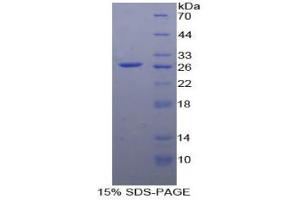 SDS-PAGE analysis of Human EP2 Protein.