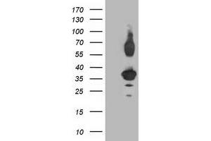 Western Blotting (WB) image for anti-Pleckstrin Homology Domain Containing Family A3 (PLEKHA3) antibody (ABIN1500275) (PLEKHA3 antibody)