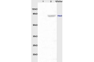 Lane 1: rat kidney lysates Lane 2: mouse intestine lysates probed with Anti P-cadherin Polyclonal Antibody, Unconjugated (ABIN738531) at 1:200 in 4 °C. (P-Cadherin antibody  (AA 625-725))