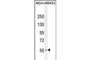 ESR1 antibody (ABIN659085 and ABIN2838074) western blot analysis in MDA-M cell line lysates (35 μg/lane). (Estrogen Receptor alpha antibody)