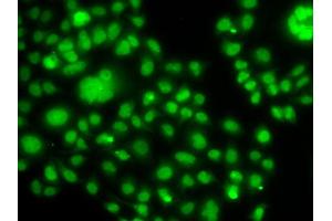Immunofluorescence analysis of MCF7 cell using SOX14 antibody.