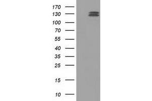 Western Blotting (WB) image for anti-L1 Cell Adhesion Molecule (L1CAM) antibody (ABIN1499085) (L1CAM antibody)
