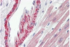 Human Heart: Formalin-Fixed, Paraffin-Embedded (FFPE) (AP1S2 antibody  (AA 1-122))