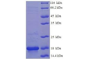Frataxin (FXN) (AA 42-210) protein (His tag) expressed in E.