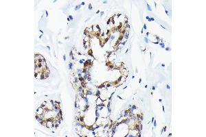 Immunohistochemistry (IHC) image for anti-Small Ubiquitin Related Modifier Protein 1 (SUMO1) antibody (ABIN7270373)