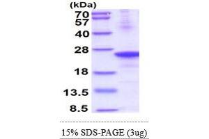 SDS-PAGE (SDS) image for C-Type Lectin Domain Family 4, Member E (CLEC4E) (AA 41-219) protein (His tag) (ABIN5854155)