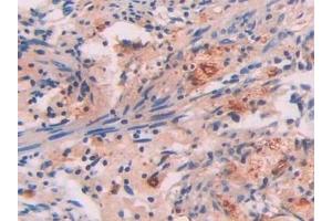 Immunohistochemistry (IHC) image for anti-Amyloid P Component, Serum (APCS) (AA 23-223) antibody (ABIN7438559)