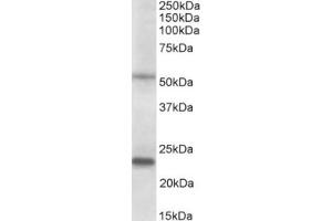 Western Blotting (WB) image for anti-Matrix Metallopeptidase 3 (Stromelysin 1, Progelatinase) (MMP3) (AA 459-473), (C-Term) antibody (ABIN2465159) (MMP3 antibody  (C-Term))