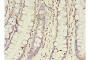 Immunohistochemistry of paraffin-embedded human colon tissue using ABIN7145877 at dilution of 1:100 (BTN2A1 antibody  (AA 29-248))
