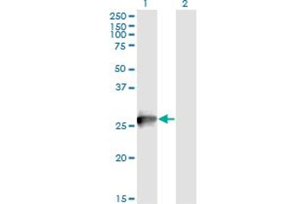 RAB3B antibody  (AA 120-219)