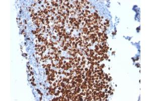 Formalin-fixed, paraffin-embedded human Tonsil stained with Ki67-Monospecific Mouse Monoclonal Antibody (MKI67/2462).