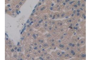 Detection of DAPP1 in Mouse Liver Tissue using Polyclonal Antibody to Dual Adaptor Of Phosphotyrosine And 3-Phosphoinositides (DAPP1) (DAPP1 antibody  (AA 1-280))