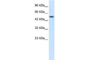 WB Suggested Anti-SBZF3 Antibody Titration:  1. (ZNF695 antibody  (N-Term))