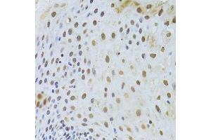 Immunohistochemistry of paraffin-embedded human esophagus using KRT8 Antibody. (KRT8 antibody  (AA 1-483))