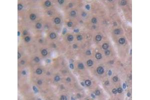 Used in DAB staining on fromalin fixed paraffin- embedded Kidney tissue (Angiostatin antibody  (AA 100-434))