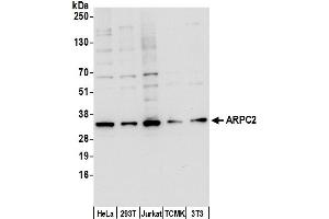 Western Blotting (WB) image for anti-Actin Related Protein 2/3 Complex, Subunit 2, 34kDa (ARPC2) (AA 175-225) antibody (ABIN7449982)