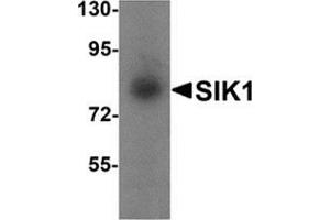 Western blot analysis of SIK1 in human small intestine tissue lysate with SIK1 antibody at 1 μg/ml. (SIK1 antibody  (Center))