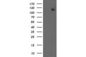 HEK293T cells were transfected with the pCMV6-ENTRY control (Left lane) or pCMV6-ENTRY ERCC4 (Right lane) cDNA for 48 hrs and lysed. (ERCC4 antibody)