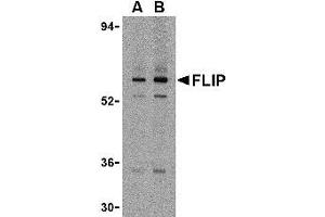 Western blot analysis of FLIP in K562 cell lysate with AP30341PU-N FLIP antibody at (A) 1 and (B) 2 μg/ml. (FLIP antibody  (N-Term))