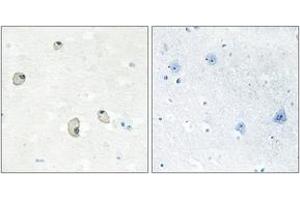 Immunohistochemistry analysis of paraffin-embedded human brain tissue, using CDH22 Antibody. (CDH22 antibody  (AA 111-160))