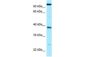WB Suggested Anti-LOC647589 Antibody Titration: 1. (ANHX antibody  (C-Term))