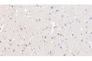 Detection of CHRNa7 in Human Cerebrum Tissue using Polyclonal Antibody to Cholinergic Receptor, Nicotinic, Alpha 7 (CHRNa7) (CHRNA7 antibody  (AA 23-230))