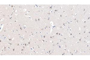 Detection of CHRNa7 in Human Cerebrum Tissue using Polyclonal Antibody to Cholinergic Receptor, Nicotinic, Alpha 7 (CHRNa7) (CHRNA7 antibody  (AA 23-230))