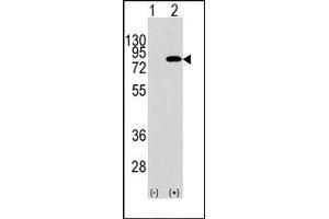 Image no. 1 for anti-Phosphoinositide 3 Kinase, p85 beta (PI3K p85b) (Tyr467) antibody (ABIN360466) (PIK3R2 antibody  (Tyr467))
