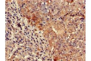 Immunohistochemistry of paraffin-embedded human adrenal gland tissue using ABIN7161691 at dilution of 1:100 (TYK2 antibody  (AA 286-372))