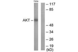 Western blot analysis of extracts from HeLa cells, treated with Insulin 0. (AKT1 antibody  (AA 292-341))