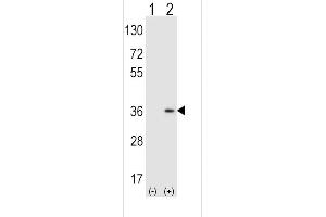 Western blot analysis of SULT1A1 (arrow) using rabbit polyclonal SULT1A1 Antibody  (ABIN389136 and ABIN2839312).