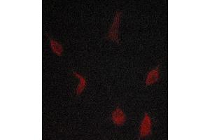 ABIN6268894 staining lovo cells by ICC/IF. (TGFBR1 antibody  (Internal Region))