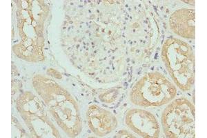 Immunohistochemistry of paraffin-embedded human kidney tissue using ABIN7157806 at dilution of 1:100 (DCXR antibody  (AA 1-244))