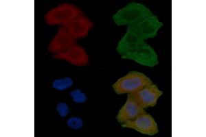 ABIN7094520 and ABIN7098569 staining Hela cells(24h of starvation treatment) by IF/ICC. (HTR7 antibody  (N-Term))