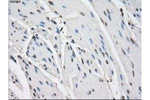 Image no. 4 for anti-Fc gamma RII (CD32) antibody (ABIN1497255) (Fc gamma RII (CD32) antibody)