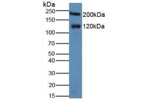 Figure. (Maltase-Glucoamylase (MGAM) (AA 213-392) antibody)