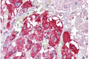 Anti-TPTE antibody IHC staining of human adrenal. (TPTE antibody  (AA 371-383))