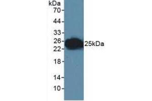 Figure. (F11R antibody  (AA 64-249))