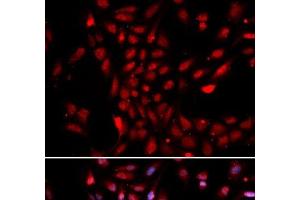 Immunofluorescence analysis of U2OS cells using KPNA4 Polyclonal Antibody (KPNA4 antibody)
