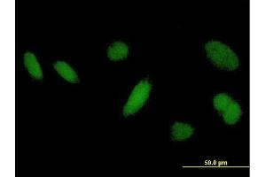 Immunofluorescence of purified MaxPab antibody to DHRSX on HeLa cell.