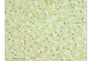 Immunohistochemistry of paraffin-embedded human liver tissue using ABIN7155970 at dilution of 1:100 (HYAL1 antibody  (AA 136-435))