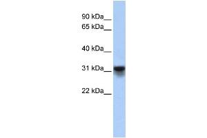 WB Suggested Anti-KDELR3 Antibody Titration:  0. (KDELR3 antibody  (Middle Region))