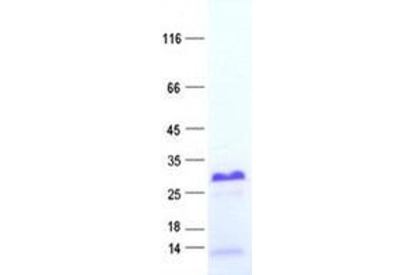 X Antigen Family, Member 3 (XAGE3) protein (His tag)