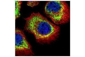 ICC/IF Image Confocal immunofluorescence analysis (Olympus FV10i) of methanol-fixed A431, using alpha Adducin, antibody (Green) at 1:500 dilution. (alpha Adducin antibody)