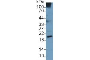 Detection of UCN3 in Human A549 cell lysate using Monoclonal Antibody to Urocortin 3 (UCN3) (UCN3 antibody  (AA 22-161))